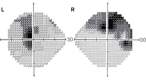 Image module